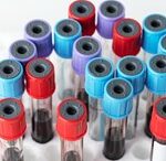 Imagem_Consulta de enfermagem para pessoas com hemofilia